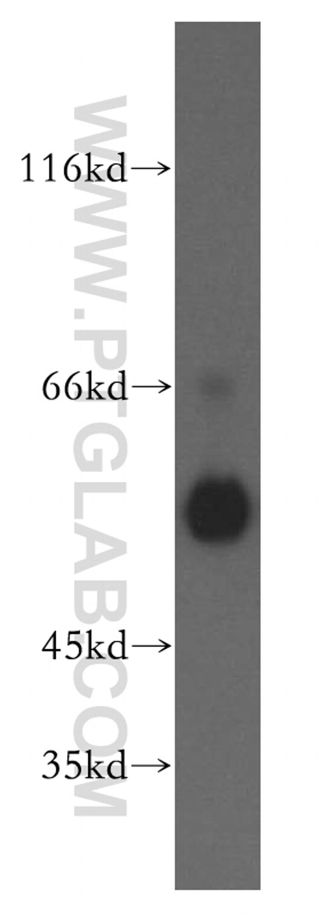 FKBP8 Antibody in Western Blot (WB)