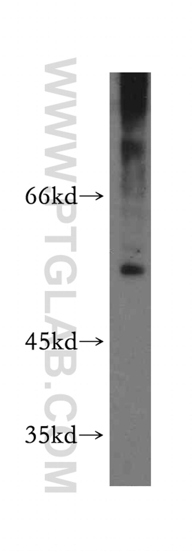 FKBP8 Antibody in Western Blot (WB)