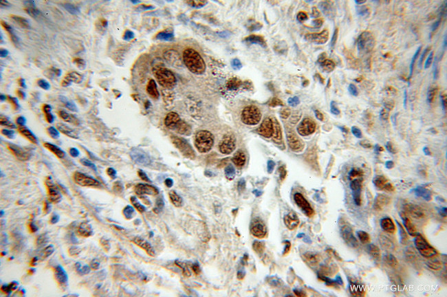 PSMA1 Antibody in Immunohistochemistry (Paraffin) (IHC (P))