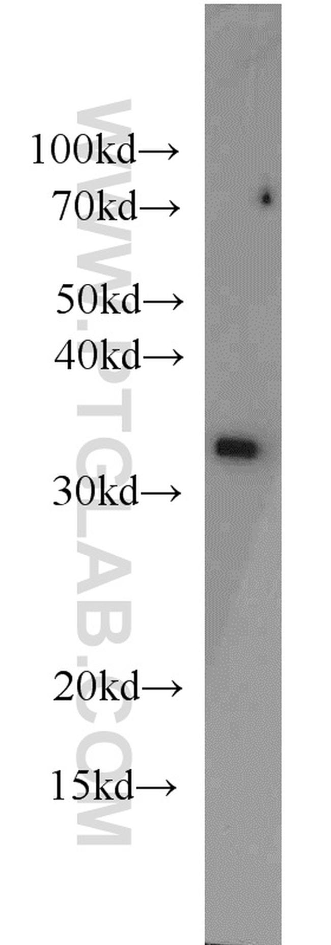 PSMA1 Antibody in Western Blot (WB)