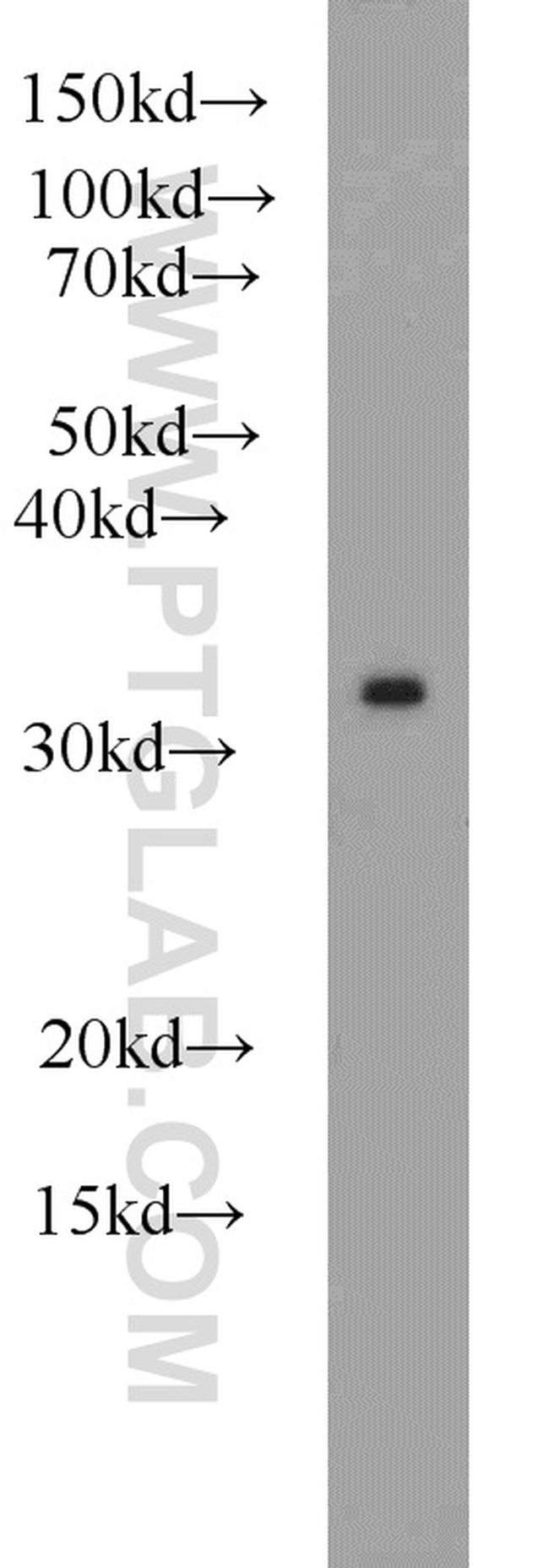 PSMA1 Antibody in Western Blot (WB)