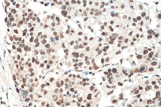 HNRNPA1 Antibody in Immunohistochemistry (Paraffin) (IHC (P))