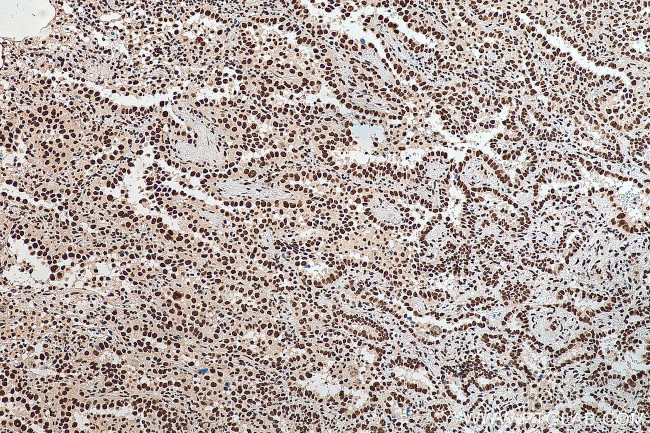 HNRNPA1 Antibody in Immunohistochemistry (Paraffin) (IHC (P))