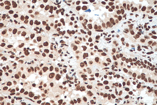 HNRNPA1 Antibody in Immunohistochemistry (Paraffin) (IHC (P))