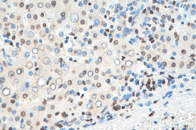 HNRNPA1 Antibody in Immunohistochemistry (Paraffin) (IHC (P))