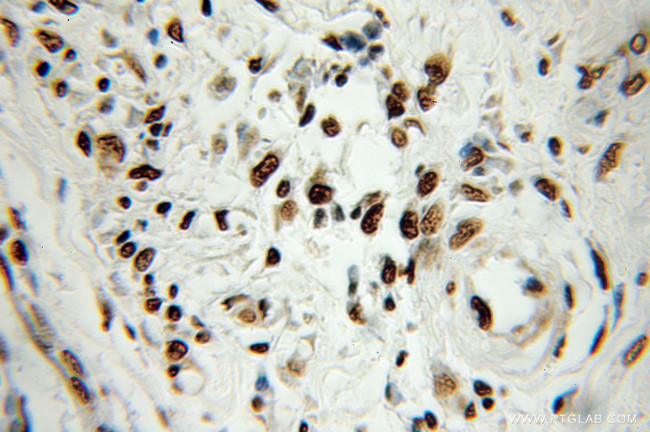 HNRNPA1 Antibody in Immunohistochemistry (Paraffin) (IHC (P))