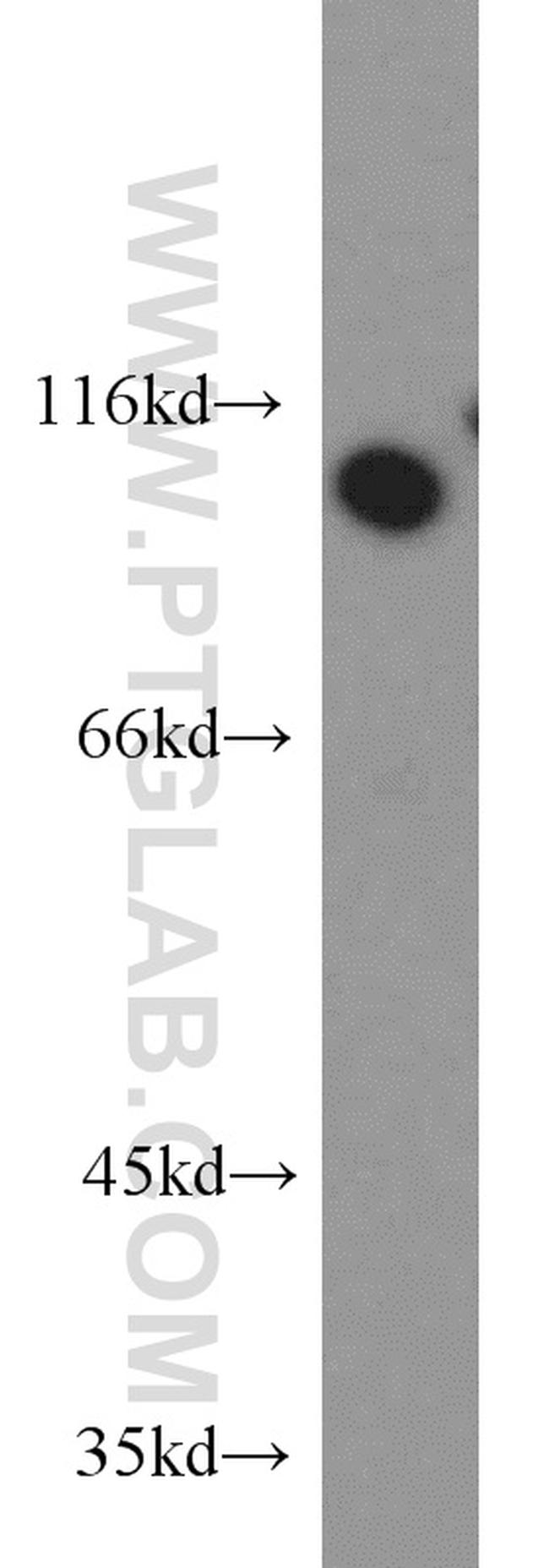 OGFR Antibody in Western Blot (WB)