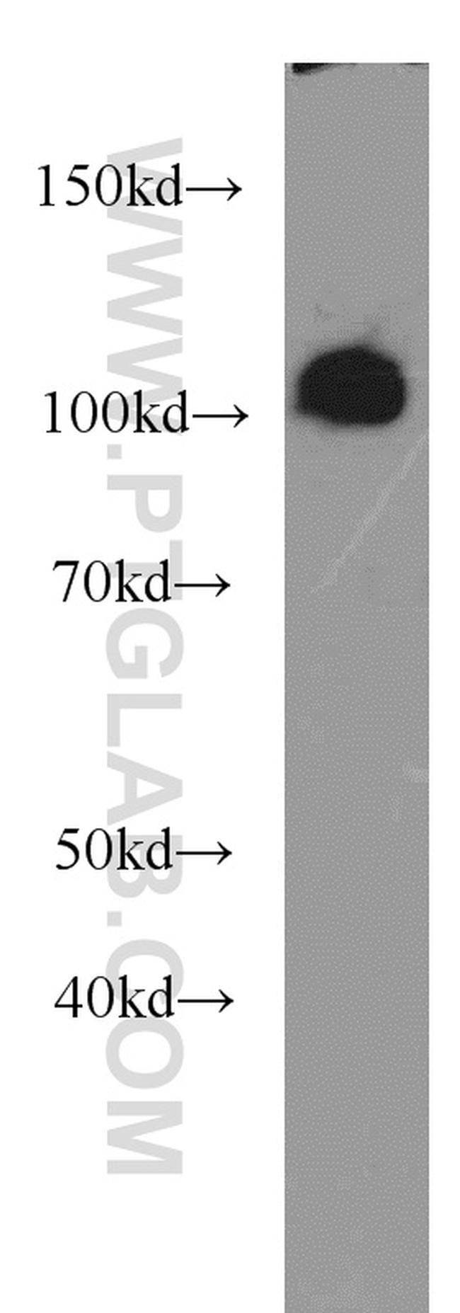 OGFR Antibody in Western Blot (WB)