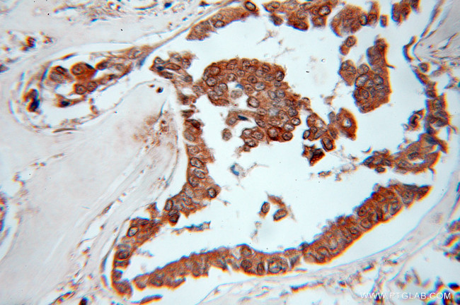 EXOSC10 Antibody in Immunohistochemistry (Paraffin) (IHC (P))