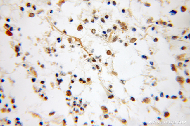 NUDT6 Antibody in Immunohistochemistry (Paraffin) (IHC (P))