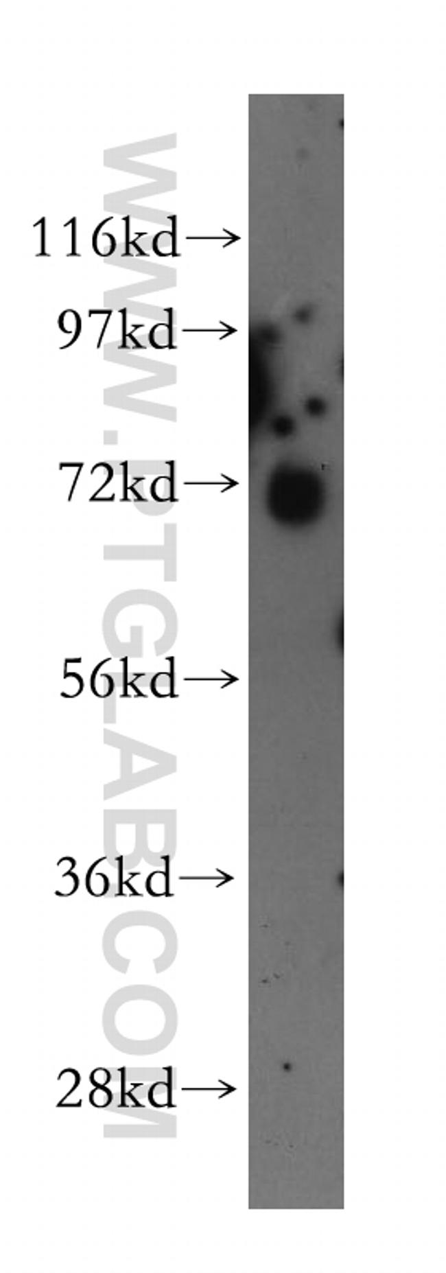 NUDT6 Antibody in Western Blot (WB)