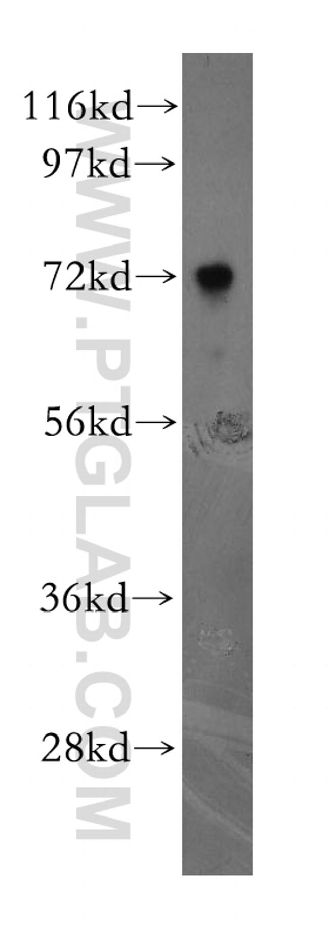 NUDT6 Antibody in Western Blot (WB)