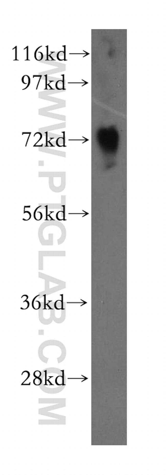 NUDT6 Antibody in Western Blot (WB)