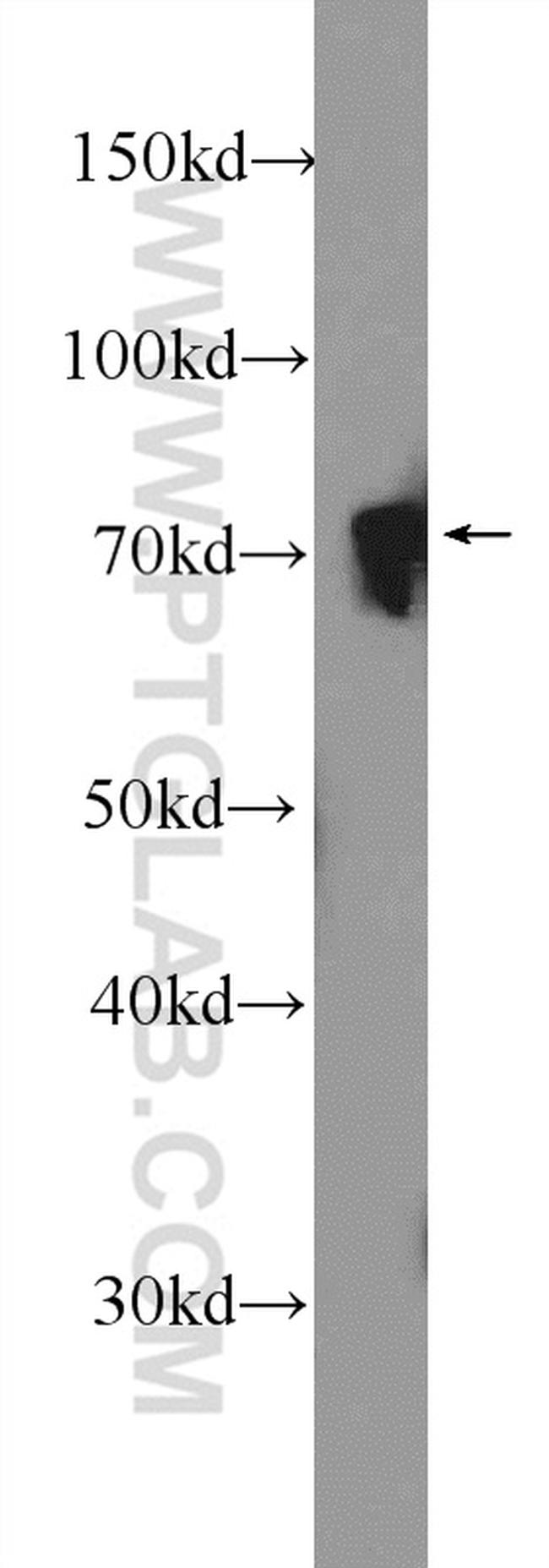 NUDT6 Antibody in Western Blot (WB)