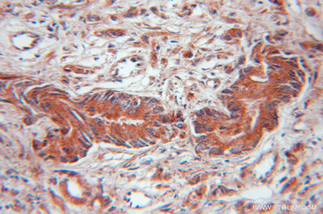 EIF4EBP2 Antibody in Immunohistochemistry (Paraffin) (IHC (P))