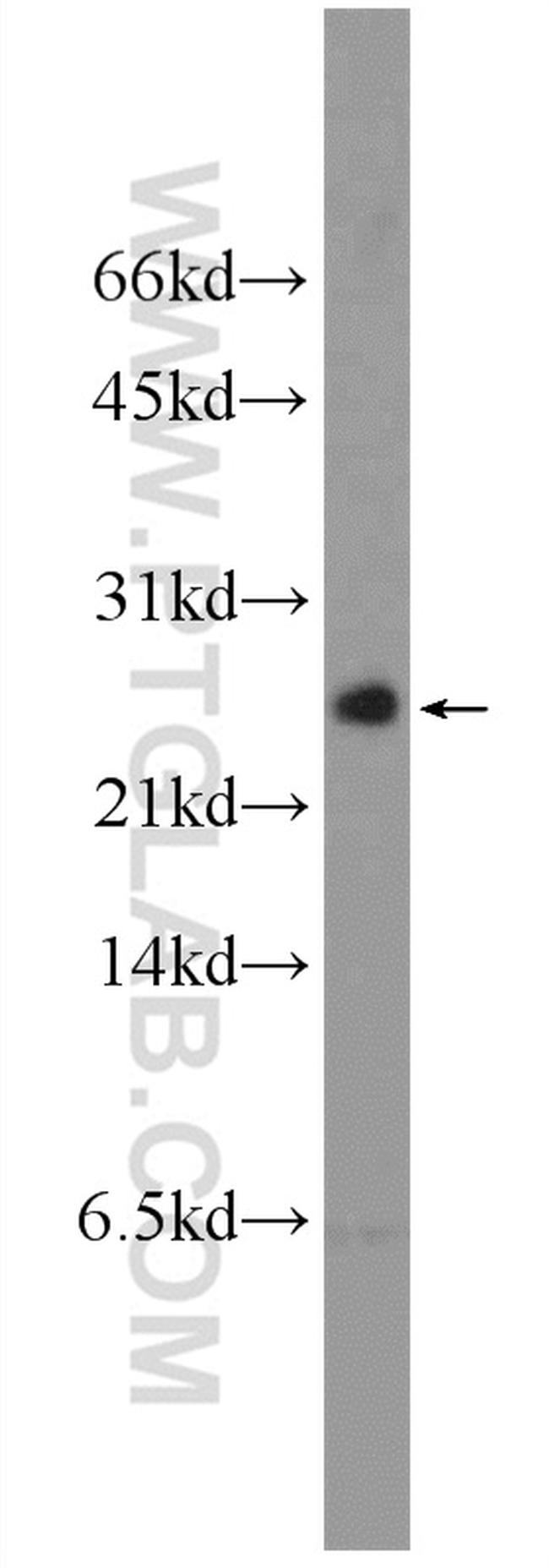 EIF4EBP2 Antibody in Western Blot (WB)