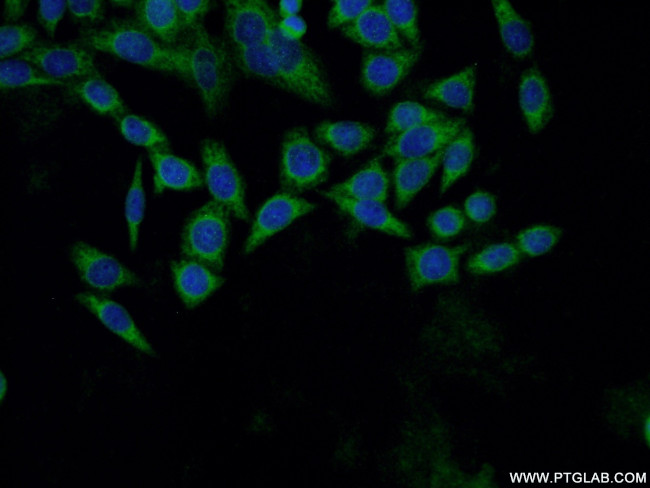 DHPS Antibody in Immunocytochemistry (ICC/IF)