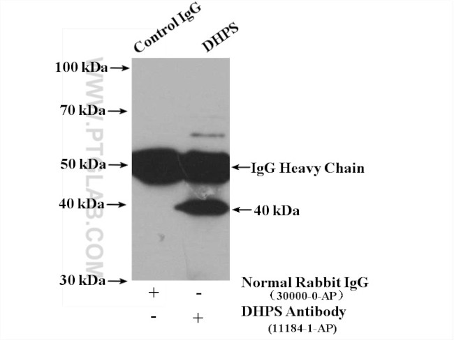 DHPS Antibody in Immunoprecipitation (IP)