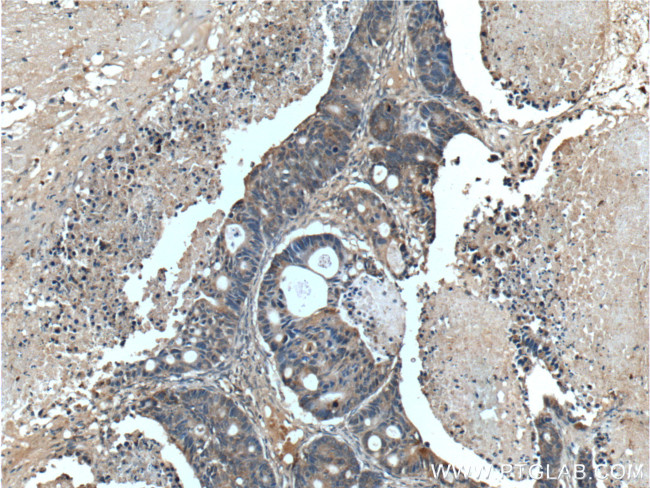 SGK2 Antibody in Immunohistochemistry (Paraffin) (IHC (P))