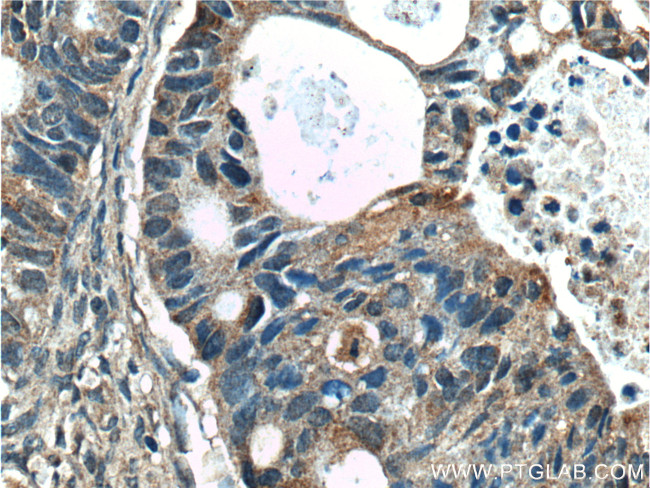 SGK2 Antibody in Immunohistochemistry (Paraffin) (IHC (P))