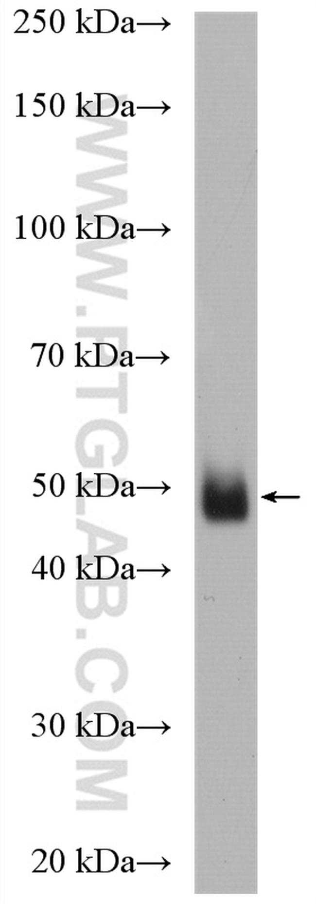 SGK2 Antibody in Western Blot (WB)