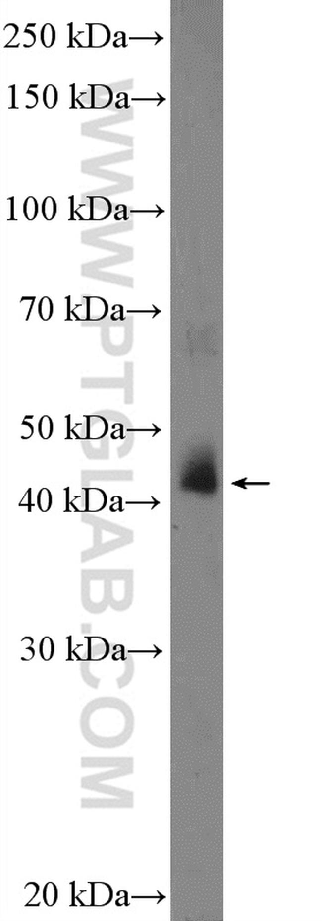 SGK2 Antibody in Western Blot (WB)