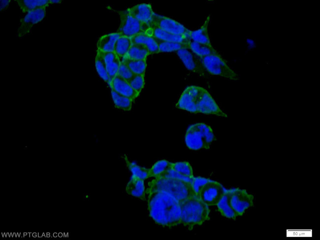 ALPL Antibody in Immunocytochemistry (ICC/IF)