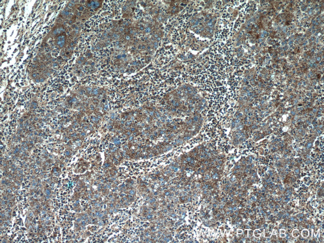 ALPL Antibody in Immunohistochemistry (Paraffin) (IHC (P))