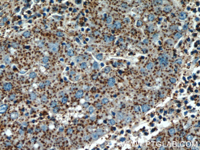 ALPL Antibody in Immunohistochemistry (Paraffin) (IHC (P))