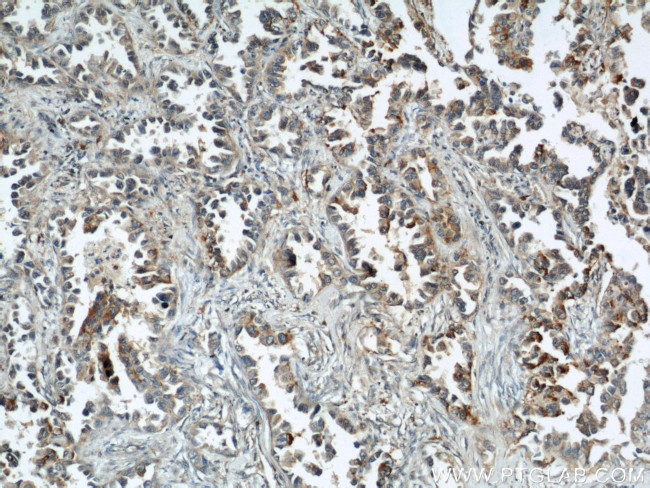 ALPL Antibody in Immunohistochemistry (Paraffin) (IHC (P))