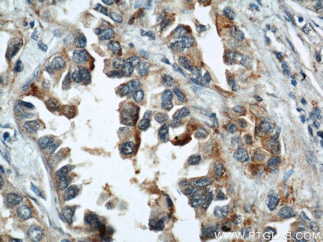 ALPL Antibody in Immunohistochemistry (Paraffin) (IHC (P))