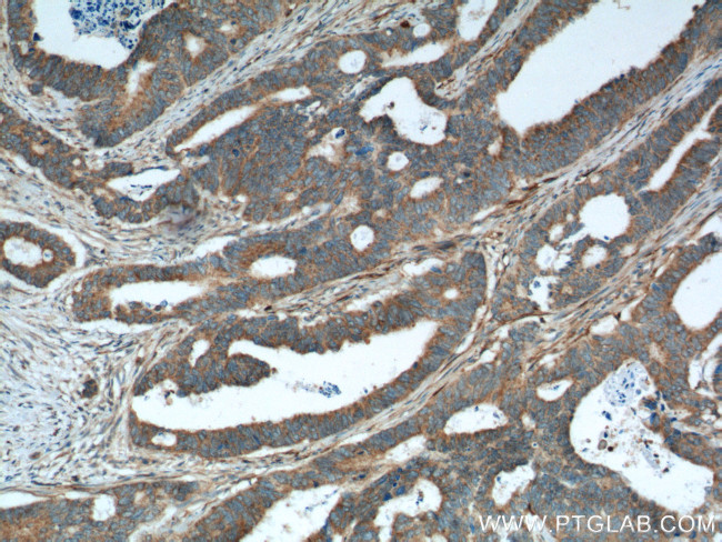 ALPL Antibody in Immunohistochemistry (Paraffin) (IHC (P))