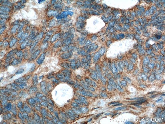 ALPL Antibody in Immunohistochemistry (Paraffin) (IHC (P))