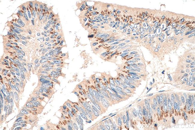 ALPL Antibody in Immunohistochemistry (Paraffin) (IHC (P))