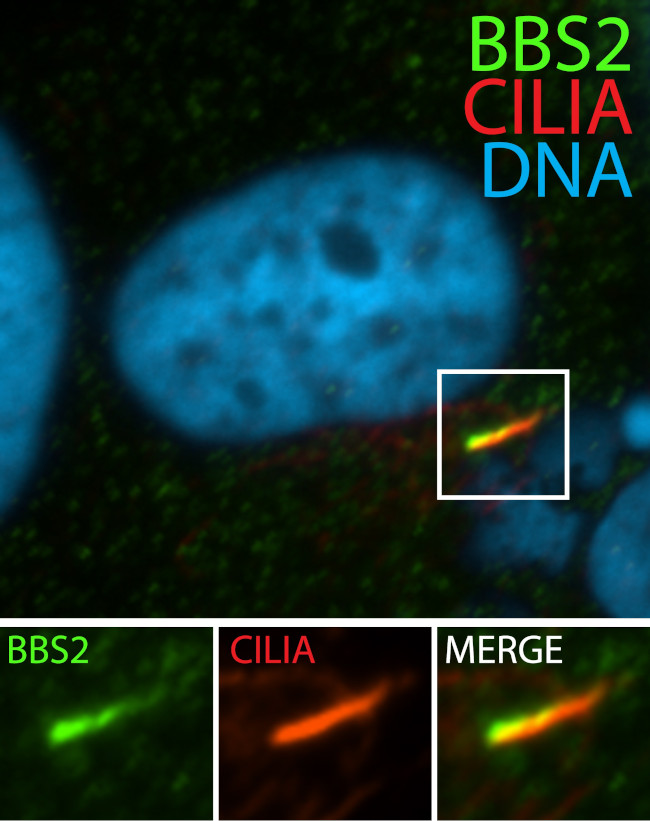 BBS2 Antibody in Immunocytochemistry (ICC/IF)