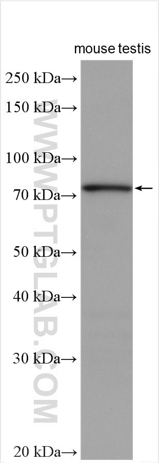 BBS2 Antibody in Western Blot (WB)