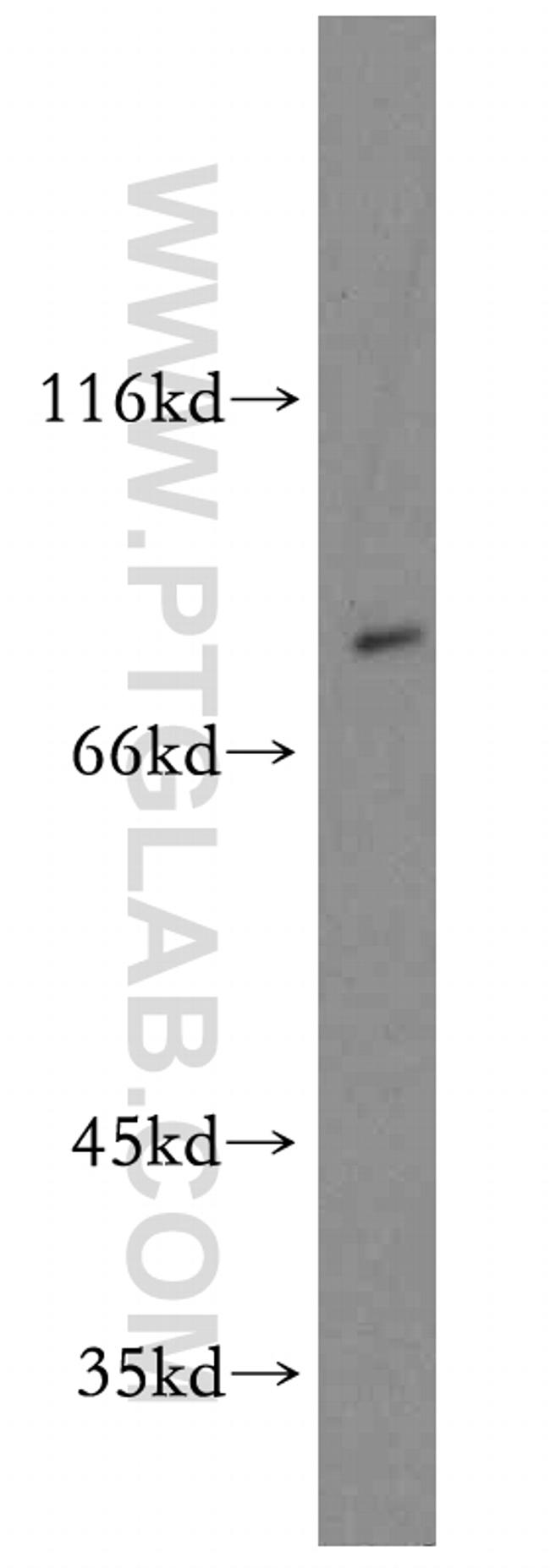 BBS2 Antibody in Western Blot (WB)