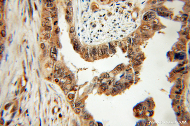 PTER Antibody in Immunohistochemistry (Paraffin) (IHC (P))