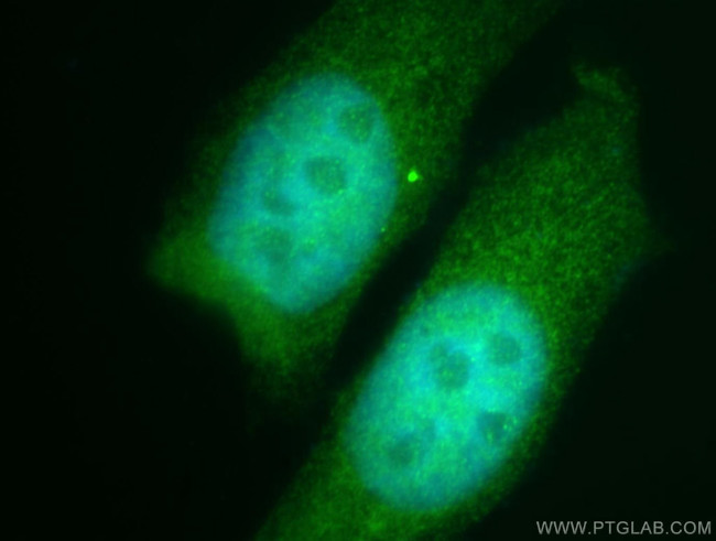 NEK9 Antibody in Immunocytochemistry (ICC/IF)