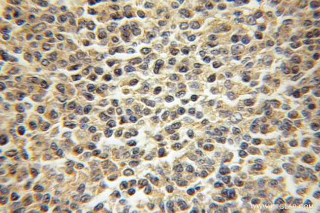 NEK9 Antibody in Immunohistochemistry (Paraffin) (IHC (P))