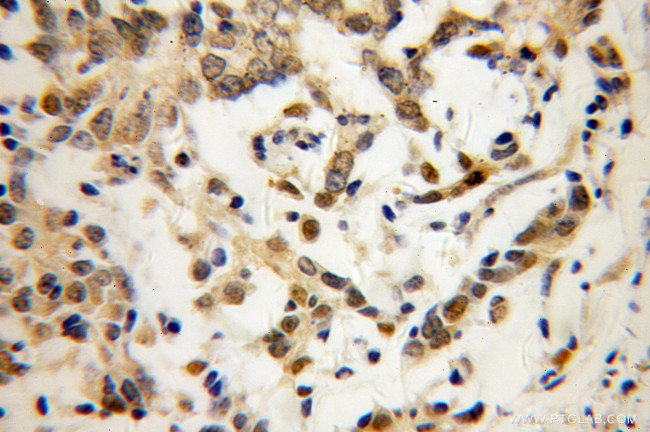 AKR1C3 Antibody in Immunohistochemistry (Paraffin) (IHC (P))