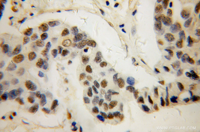 AKR1C3 Antibody in Immunohistochemistry (Paraffin) (IHC (P))