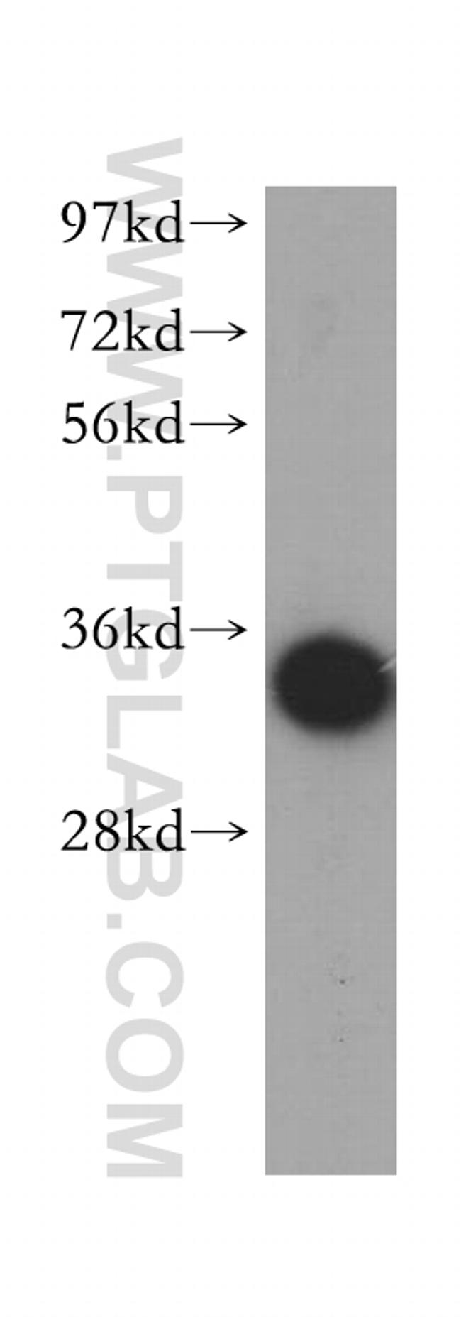 AKR1C3 Antibody in Western Blot (WB)