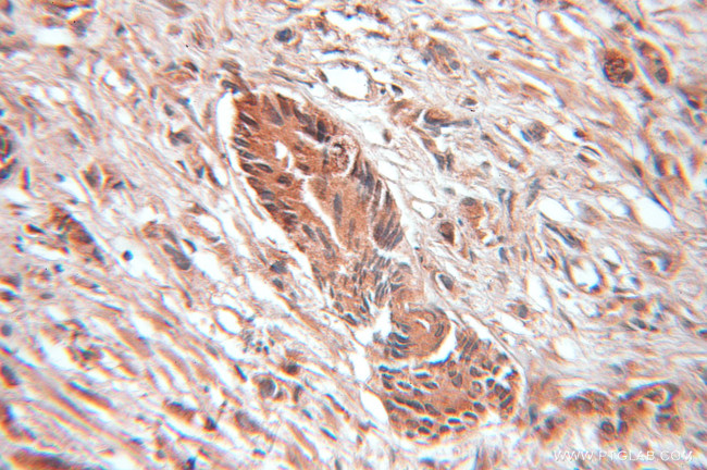 SRP9 Antibody in Immunohistochemistry (Paraffin) (IHC (P))