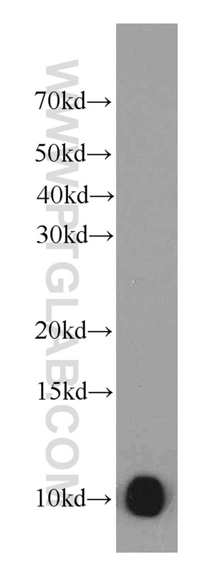 SRP9 Antibody in Western Blot (WB)