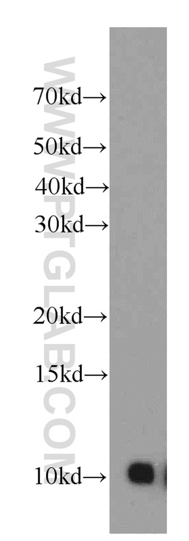 SRP9 Antibody in Western Blot (WB)