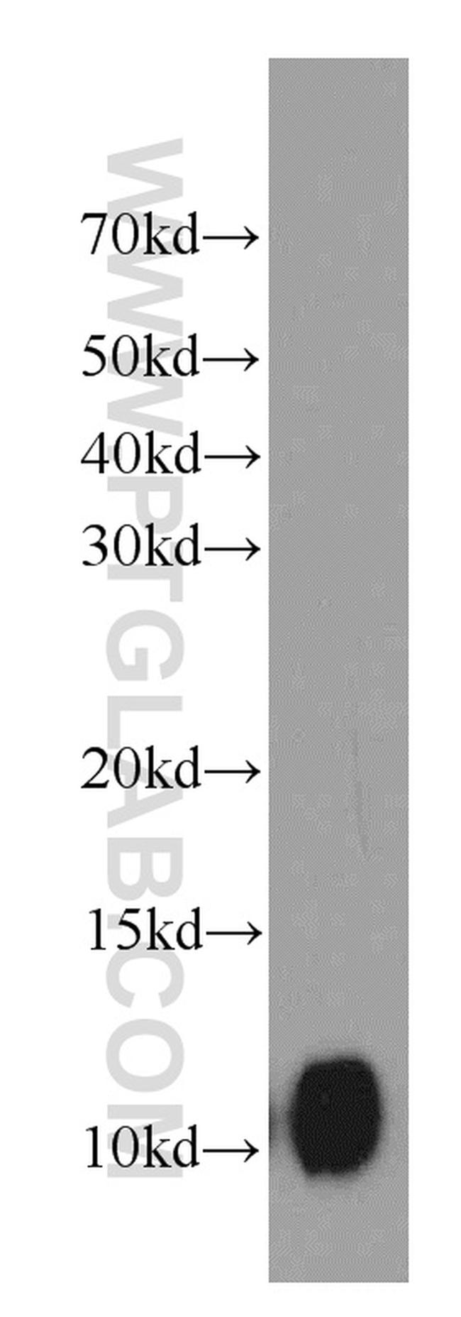 SRP9 Antibody in Western Blot (WB)