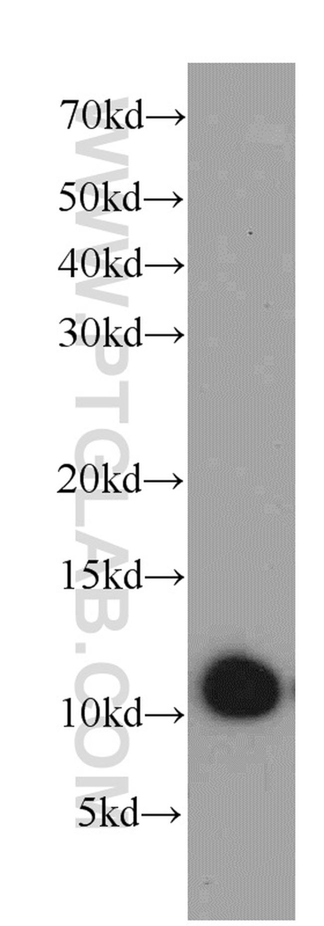 SRP9 Antibody in Western Blot (WB)