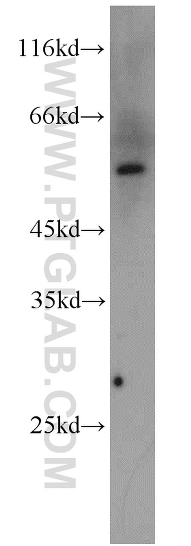 PSMC1 Antibody in Western Blot (WB)