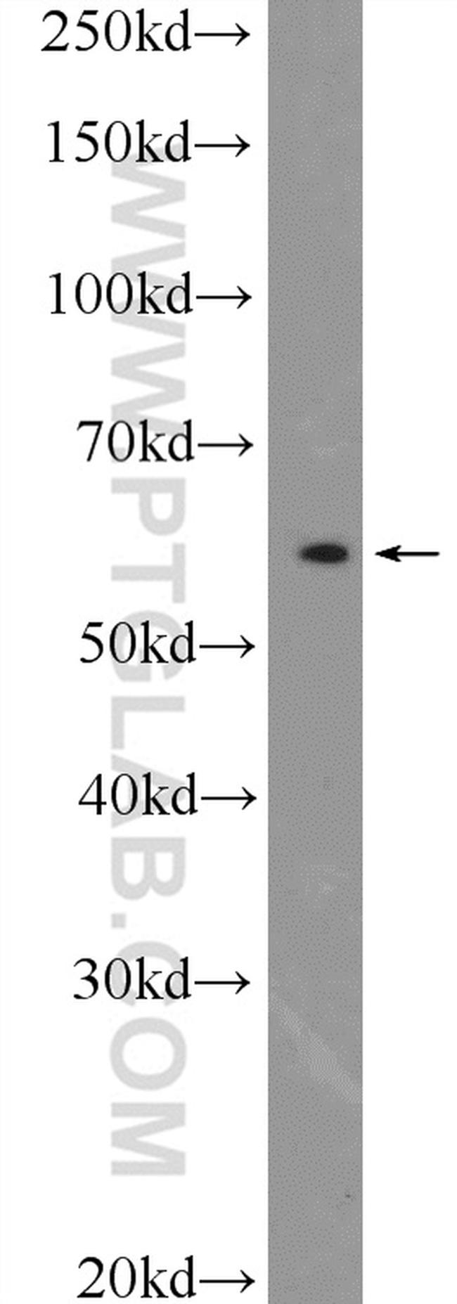 PSMC1 Antibody in Western Blot (WB)